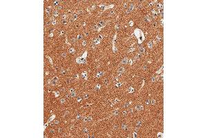 Immunohistochemical analysis of paraffin-embedded Human brain tissue using (ABIN6242238 and ABIN6577695) performed on the Leica® BOND RXm. (CD56 anticorps  (C-Term))