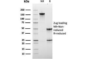 SDS-PAGE Analysis Purified Monospecific Mouse Monoclonal Antibody to LAG-3 (LAG3/3261). (LAG3 anticorps)