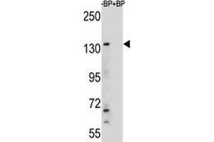 Western blot analysis of JMJD3 antibody and HeLa lysate (Kdm6b anticorps  (AA 954-987))
