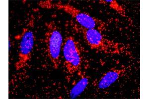 Proximity Ligation Analysis of protein-protein interactions between ACTN4 and CTNNB1.