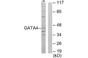 Western blot analysis of extracts from Jurkat cells, using GATA4 antibody. (GATA4 anticorps  (Internal Region))