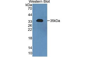 Western blot analysis of the recombinant protein. (SGK2 anticorps  (AA 40-311))