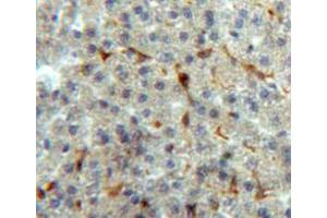 Used in DAB staining on fromalin fixed paraffin-embedded liver tissue