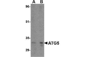 Western blot. (ATG5 anticorps  (N-Term))