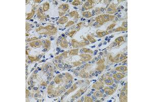 Immunohistochemistry of paraffin-embedded human stomach using PTK7 antibody. (PTK7 anticorps)