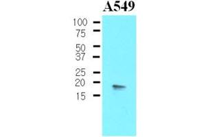 Western blot analysis: The Cell lysates of A549 (30ug) were resolved by SDS-PAGE, transferred to NC membrane and probed with anti-human PPP1R14A (1:500). (CPI-17 anticorps)