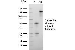SDS-PAGE Analysis Purified C1QA Mouse Monoclonal Antibody (C1QA/2956). (C1QA anticorps  (AA 104-237))