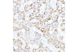 Immunohistochemistry of paraffin-embedded human liver using Kaiso/Kaiso/ZBTB33 Rabbit pAb  at dilution of 1:350 (40x lens). (ZBTB33 anticorps  (AA 523-672))