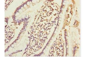 Immunohistochemistry of paraffin-embedded human small intestine tissue using ABIN7152002 at dilution of 1:100