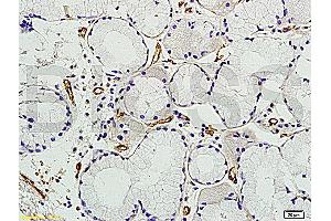 Formalin-fixed and paraffin embedded human colon tissue labeled with Anti Prominin2 Polyclonal Antibody, unconjugated (ABIN715151) at 1:200 followed by incubation with conjugated secondary antibody and DAB staining (Prominin 2 anticorps  (AA 301-400))