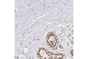 Immunohistochemical staining of human breast with ZNF275 polyclonal antibody  shows strong nuclear positivity in glandular cells.