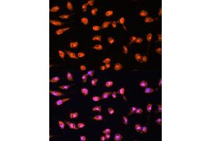 Immunofluorescence analysis of L929 cells using PRKCB antibody (ABIN6128463, ABIN6146200, ABIN6146202 and ABIN6221544) at dilution of 1:100.