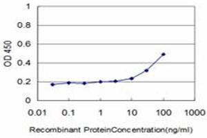 Detection limit for recombinant GST tagged DLD is approximately 1ng/ml as a capture antibody. (DLD anticorps  (AA 1-509))