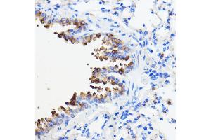 Immunohistochemistry of paraffin-embedded mouse lung using TMED3 antibody (ABIN7270944) at dilution of 1:100 (40x lens). (TMED3 anticorps  (AA 24-180))