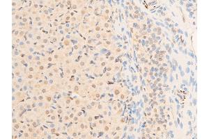 ABIN6267218 at 1/100 staining rat ovarian tissue sections by IHC-P.