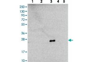 Western blot analysis of Lane 1: RT-4, Lane 2: U-251 MG, Lane 3: Human Plasma, Lane 4: Liver, Lane 5: Tonsil with NDUFB9 polyclonal antibody  at 1:250-1:500 dilution.