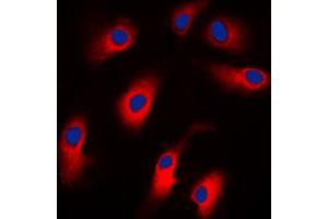 Immunofluorescent analysis of Cytokeratin 18 staining in MCF7 cells. (Cytokeratin 18 anticorps  (N-Term))