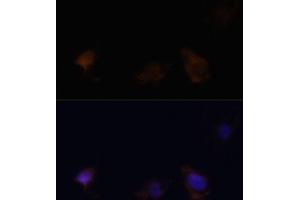 Immunofluorescence analysis of C6 cells using Zyxinin antibody (ABIN3023008, ABIN3023009, ABIN3023010 and ABIN6219343) at dilution of 1:100. (ZYX anticorps  (AA 1-300))