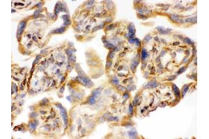 IHC analysis of COMT using anti-COMT antibody .