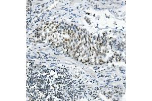 IHC analysis of PRDM5 using anti-PRDM5 antibody (ABIN7600853). (PRDM5 anticorps  (AA 24-630))