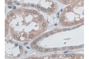 Detection of MHCB in Human Kidney Tissue using Polyclonal Antibody to Major Histocompatibility Complex Class I B (MHCB)