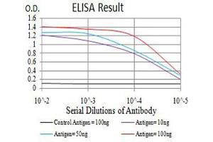 Black line: Control Antigen (100 ng),Purple line: Antigen (10 ng), Blue line: Antigen (50 ng), Red line:Antigen (100 ng)