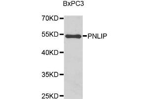 Western blot analysis of BxPC3 cell lysate using PNLIP antibody. (PNLIP anticorps)