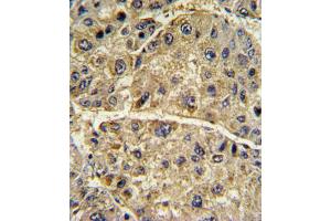 Immunohistochemistry (IHC) image for anti-Collagen, Type VI, alpha 1 (COL6A1) antibody (ABIN3002699)