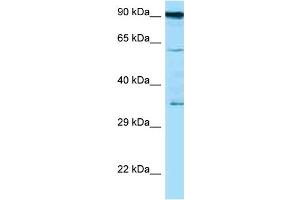 Western Blotting (WB) image for anti-CD82 (CD82) (C-Term) antibody (ABIN2789464) (CD82 anticorps  (C-Term))