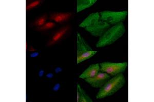 ABIN6261798 and ABIN6278670 staining  cells by IF/ICC. (FOXN1 anticorps  (N-Term))