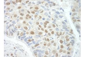 anti-Pogo Transposable Element with ZNF Domain (POGZ) (AA 1360-1410) antibody