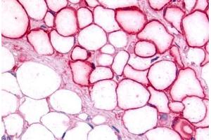 Anti-LRH-1 / NR5A2 antibody IHC staining of human adipocytes.