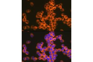 Immunofluorescence analysis of Jurkat cells using CD82 Rabbit mAb (ABIN7266222) at dilution of 1:100 (40x lens).