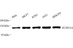 Western blot analysis of ZC3H11A (ABIN7076255) at dilution of 1: 1000 (ZC3H11A anticorps)