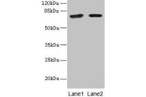 Western blot All lanes: KLHL22 antibody at 8 μg/mL Lane 1: Jurkat whole cell lysate Lane 2: NIH/3T3 whole cell lysate Secondary Goat polyclonal to rabbit IgG at 1/10000 dilution Predicted band size: 72, 56 kDa Observed band size: 72 kDa (KLHL22 anticorps  (AA 2-300))