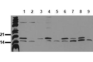 Western Blotting (WB) image for anti-Microtubule-Associated Protein 1 Light Chain 3 beta (MAP1LC3B) (N-Term) antibody (ABIN492615) (LC3B anticorps  (N-Term))