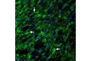 Expression of Glucagon-like peptide 1 receptor in rat hypothalamus - Immunohistochemical staining of rat hypothalamus with Anti-GLP1R (extracellular) Antibody (ABIN7043219, ABIN7044406 and ABIN7044407), (1:200).