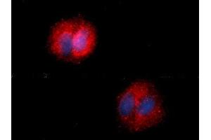 Immunofluorescence (IF) image for anti-Fatty Acid Binding Protein 5 (Psoriasis-Associated) (FABP5) (AA 1-135) antibody (PE) (ABIN5567755)