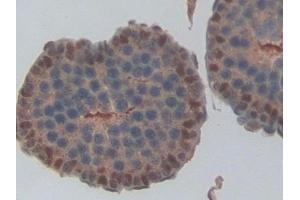 Detection of NME6 in Rat Testis Tissue using Polyclonal Antibody to Non Metastatic Cells 6, Protein Expressed In (NME6)