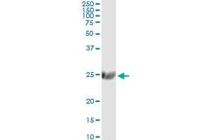 anti-ST6 beta-Galactosamide alpha-2,6-Sialyltranferase 1 (ST6GAL1) (AA 96-195) antibody