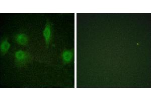 P-peptide - +Immunofluorescence analysis of HuvEc cells, using IL-9R (Phospho-Ser519) antibody. (IL9 Receptor anticorps  (pSer519))