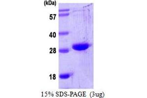 SDS-PAGE (SDS) image for Oncostatin M (OSM) (AA 26-234) protein (His tag) (ABIN667495) (Oncostatin M Protein (OSM) (AA 26-234) (His tag))