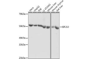 Western blot analysis of extracts of various cell lines, using EIF2S3 antibody (ABIN6130363, ABIN6140051, ABIN6140052 and ABIN6222259) at 1:1000 dilution. (EIF2S3 anticorps  (AA 173-472))