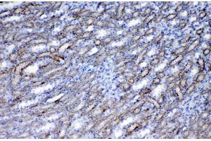 IHC analysis of Flt3 / CD135 using anti-Flt3 / CD135 antibody .