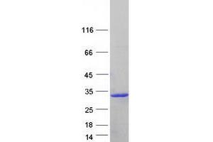 Validation with Western Blot