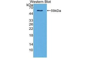 Western Blotting (WB) image for anti-Netrin 4 (NTN4) (AA 349-592) antibody (ABIN1869566) (Netrin 4 anticorps  (AA 349-592))