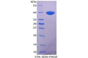 SDS-PAGE analysis of Human Keratin 5 Protein. (Cytokeratin 5 Protéine)