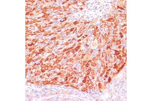 Immunohistochemistry of paraffin-embedded rat ovary using ASNS antibody (ABIN7265693) at dilution of 1:100 (40x lens). (Asparagine Synthetase anticorps  (AA 262-561))