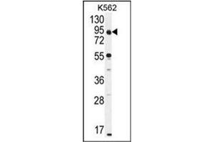 Western blot analysis of CCDC128 Antibody (Center) in K562 cell line lysates (35ug/lane). (KLRAQ1 anticorps  (Middle Region))