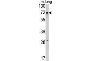 Western blot analysis of FMR1 Antibody (N-term) in mouse lung tissue lysates (35 µg/lane).